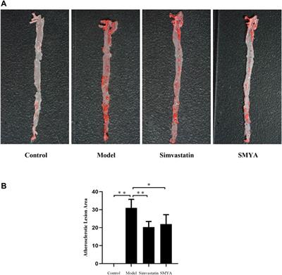 Effect and Mechanism of Si-Miao-Yong-An on Vasa Vasorum Remodeling in ApoE−/− Mice with Atherosclerosis Vulnerable Plague